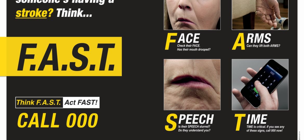 Stroke FAST - how to know if someone is having a stroke.